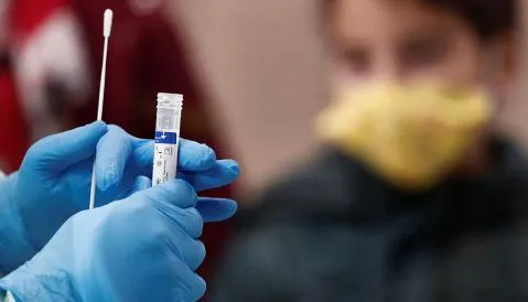 PCR