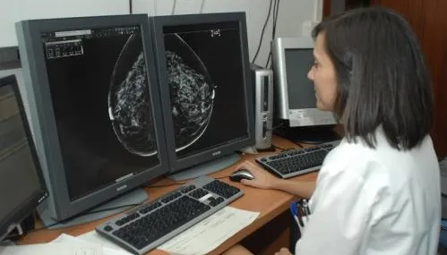 Cáncer de mama