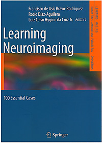 Learning neuroimaging